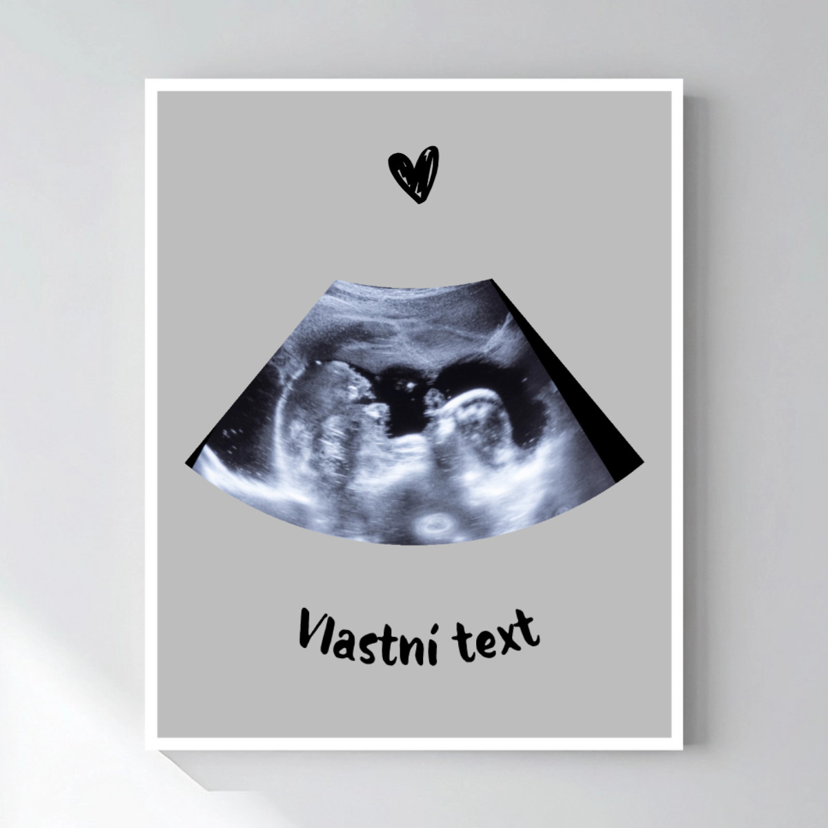 Personalizovaný magický fotob obraz v ráme – 50 × 70 – ultrazvuk