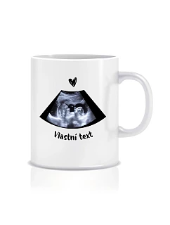 Personalizovaný klasický bílý keramický hrníček 300 ml s ultrazvukem