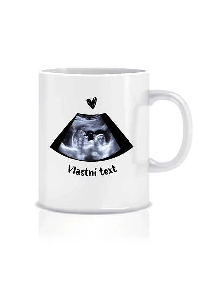 Personalizovaný klasický bílý keramický hrníček 300 ml s ultrazvukem Personalizovaný klasický bílý keramický hrníček 300 ml s ultrazvukem