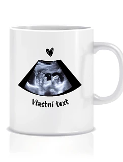Personalizovaný klasický bílý keramický hrníček 300 ml s ultrazvukem
