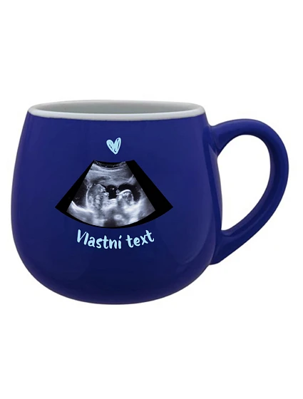 Personalizovaný keramický buclatý hrneček s ultrazvukem Personalizovaný keramický buclatý hrneček s ultrazvukem