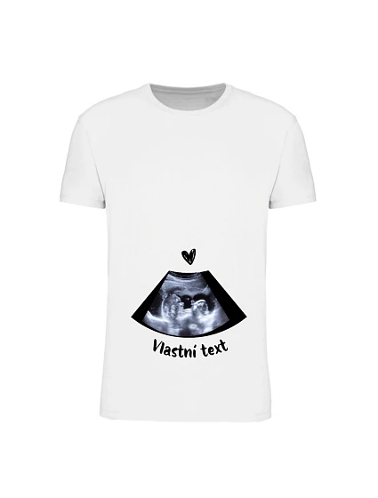 Personalizované dámské tričko - ultrazvuk
