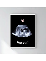 Personalizovaný magický fotoobraz v rámu - 30x40 - ultrazvuk