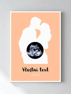 Personalizovaný magický fotoobraz v rámu - čtverec 50x70 - s párem a ultrazvukem