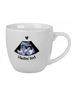 Personalizovaný keramický hrníček 400 ml s ultrazvukem