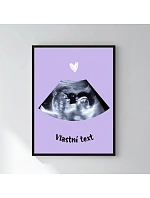 Personalizovaný magický fotoobraz v rámu - 30x40 - ultrazvuk